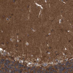 Invitrogen RAP1GDS1 Polyclonal Antibody 100 &mu;L; Unconjugated:Antibodies,