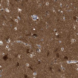 Invitrogen RAP1GDS1 Polyclonal Antibody 100 &mu;L; Unconjugated:Antibodies,
