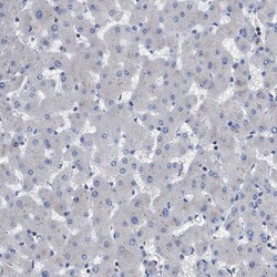 Invitrogen RAP1GDS1 Polyclonal Antibody 100 &mu;L; Unconjugated:Antibodies,