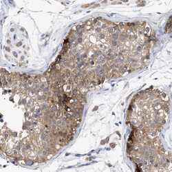Invitrogen RAP1GDS1 Polyclonal Antibody 100 &mu;L; Unconjugated:Antibodies,
