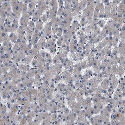 Invitrogen IFT81 Polyclonal Antibody 100 &mu;L | Buy Online | Invitrogen&trade; | Fisher Scientific