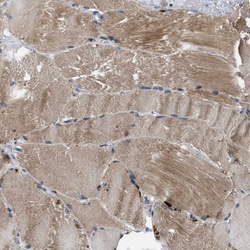 Invitrogen IFT81 Polyclonal Antibody 100 &mu;L | Buy Online | Invitrogen&trade; | Fisher Scientific