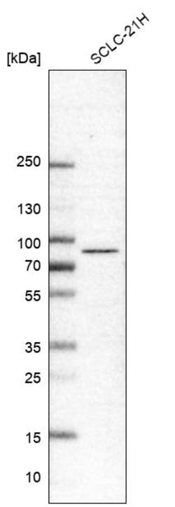 Invitrogen IFT81 Polyclonal Antibody 100 &mu;L | Buy Online | Invitrogen&trade; | Fisher Scientific