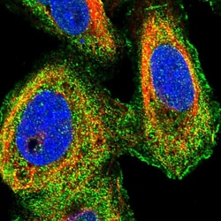 Invitrogen MIB1 Polyclonal Antibody 100 &mu;L; Unconjugated:Antikörper