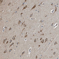 Invitrogen MIB1 Polyclonal Antibody 100 &mu;L; Unconjugated:Antikörper