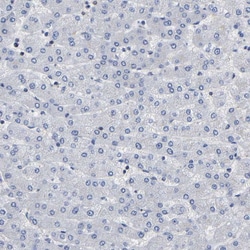 Invitrogen PTPN7 Polyclonal Antibody 100 &mu;L; Unconjugated:Antibodies,