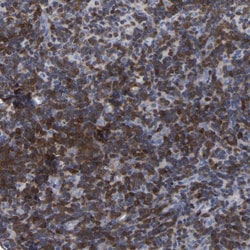 Invitrogen PTPN7 Polyclonal Antibody 100 &mu;L; Unconjugated:Antibodies,