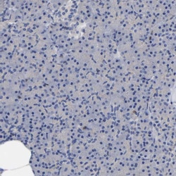 Invitrogen PTPN7 Polyclonal Antibody 100 &mu;L; Unconjugated:Antibodies,