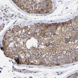 Invitrogen PTPN7 Polyclonal Antibody 100 &mu;L; Unconjugated:Antibodies,