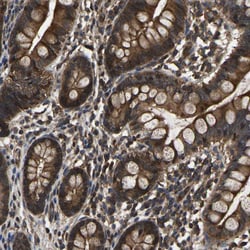 Invitrogen CRYZL1 Polyclonal Antibody 100 &mu;L; Unconjugated:Antibodies,