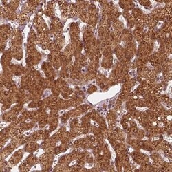 Invitrogen DNAJC25 Polyclonal Antibody 100 &mu;L; Unconjugated:Antibodies,