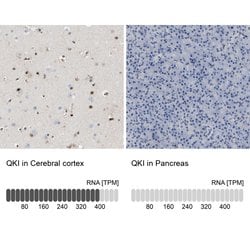 Invitrogen QKI Polyclonal Antibody 100 &mu;L; Unconjugated:Antibodies,