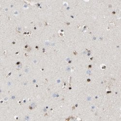 Invitrogen QKI Polyclonal Antibody 100 &mu;L; Unconjugated:Antibodies,