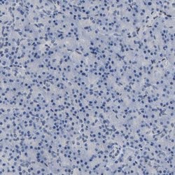Invitrogen QKI Polyclonal Antibody 100 &mu;L; Unconjugated:Antibodies,