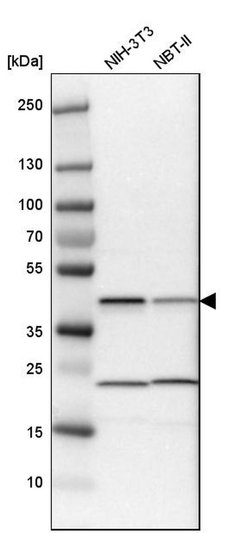 Invitrogen QKI Polyclonal Antibody 100 &mu;L; Unconjugated:Antibodies,