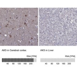 Invitrogen Adenylate Kinase 5 Polyclonal Antibody 100 &mu;L; Unconjugated:Antibodies,