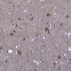 Invitrogen Adenylate Kinase 5 Polyclonal Antibody 100 &mu;L; Unconjugated:Antibodies,