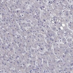 Invitrogen Adenylate Kinase 5 Polyclonal Antibody 100 &mu;L; Unconjugated:Antibodies,
