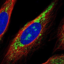 Invitrogen RNF115 Polyclonal Antibody 100 &mu;L | Buy Online | Invitrogen&trade; | Fisher Scientific