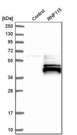 Invitrogen RNF115 Polyclonal Antibody 100 &mu;L | Buy Online | Invitrogen&trade; | Fisher Scientific
