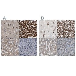 Invitrogen UQCRC2 Polyclonal Antibody 100 &mu;L; Unconjugated:Antibodies,