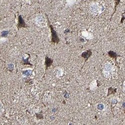 Invitrogen UQCRC2 Polyclonal Antibody 100 &mu;L; Unconjugated:Antibodies,