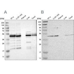 Invitrogen UQCRC2 Polyclonal Antibody 100 &mu;L; Unconjugated:Antibodies,