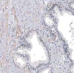 Invitrogen TMEM43 Polyclonal Antibody 100 &mu;L | Buy Online | Invitrogen&trade; | Fisher Scientific