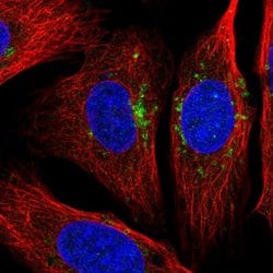 Invitrogen STARD3NL Polyclonal Antibody 100 &mu;L | Buy Online | Invitrogen&trade; | Fisher Scientific