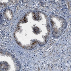 Invitrogen STARD3NL Polyclonal Antibody 100 &mu;L | Buy Online | Invitrogen&trade; | Fisher Scientific