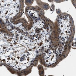 Invitrogen STARD3NL Polyclonal Antibody 100 &mu;L | Buy Online | Invitrogen&trade; | Fisher Scientific