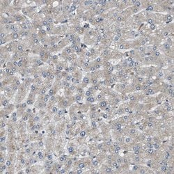 Invitrogen STARD3NL Polyclonal Antibody 100 &mu;L | Buy Online | Invitrogen&trade; | Fisher Scientific