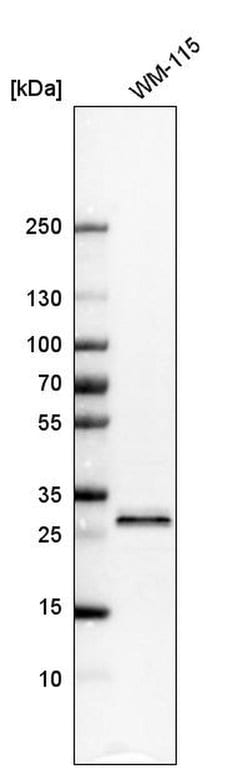 Invitrogen STARD3NL Polyclonal Antibody 100 &mu;L | Buy Online | Invitrogen&trade; | Fisher Scientific