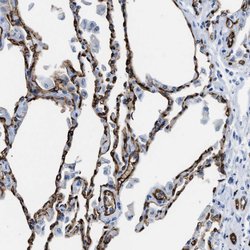 Invitrogen Aquaporin 1 Polyclonal Antibody 100 &mu;L; Unconjugated:Antibodies,