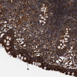 Invitrogen EPS15R Polyclonal Antibody 100 &mu;L; Unconjugated:Antibodies,