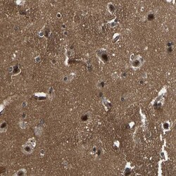 Invitrogen SRRM3 Polyclonal Antibody 100 &mu;L; Unconjugated:Antibodies,