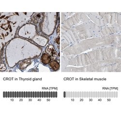 Invitrogen CROT Polyclonal Antibody 100 &mu;L; Unconjugated:Antibodies,