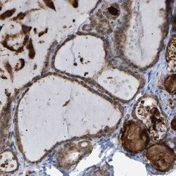 Invitrogen CROT Polyclonal Antibody 100 &mu;L; Unconjugated:Antibodies,