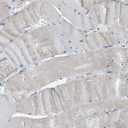 Invitrogen CROT Polyclonal Antibody 100 &mu;L; Unconjugated:Antibodies,