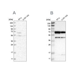 Invitrogen CROT Polyclonal Antibody 100 &mu;L; Unconjugated:Antibodies,