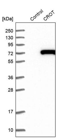 Invitrogen CROT Polyclonal Antibody 100 &mu;L; Unconjugated:Antibodies,