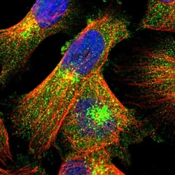 Invitrogen LRBA Polyclonal Antibody 100 &mu;L; Unconjugated:Antibodies,