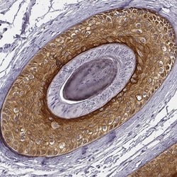 Invitrogen KRT75 Polyclonal Antibody 100 &mu;L; Unconjugated:Antibodies,