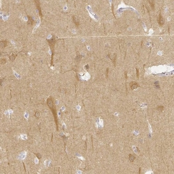 Invitrogen KCNH1 Polyclonal Antibody 100 &mu;L; Unconjugated:Antibodies,