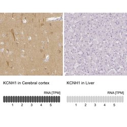 Invitrogen KCNH1 Polyclonal Antibody 100 &mu;L; Unconjugated:Antibodies,