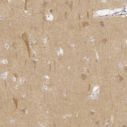Invitrogen KCNH1 Polyclonal Antibody 100 &mu;L; Unconjugated:Antibodies,
