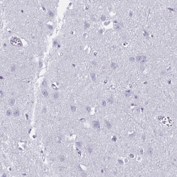 Invitrogen Defensin 6 Polyclonal Antibody 100 &mu;L; Unconjugated:Antibodies,