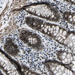 Invitrogen PRCC Polyclonal Antibody 100 &mu;L; Unconjugated:Antibodies,