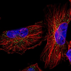 Invitrogen TRK fused gene Polyclonal Antibody 100 &mu;L; Unconjugated:Antibodies,