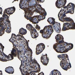 Invitrogen TRK fused gene Polyclonal Antibody 100 &mu;L; Unconjugated:Antibodies,